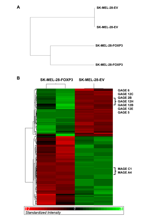 Gene expression profiling of SK-MEL-28-FOXP3 and SK-MEL-28-EV clones.
