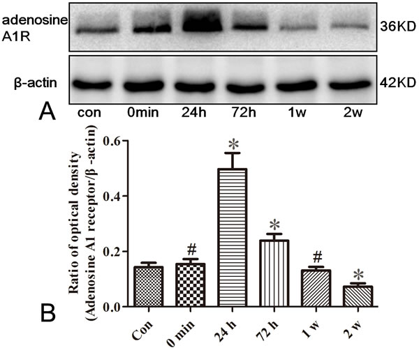 Western blotting analysis for adenosine A1 receptor in the hippocampus of rats.