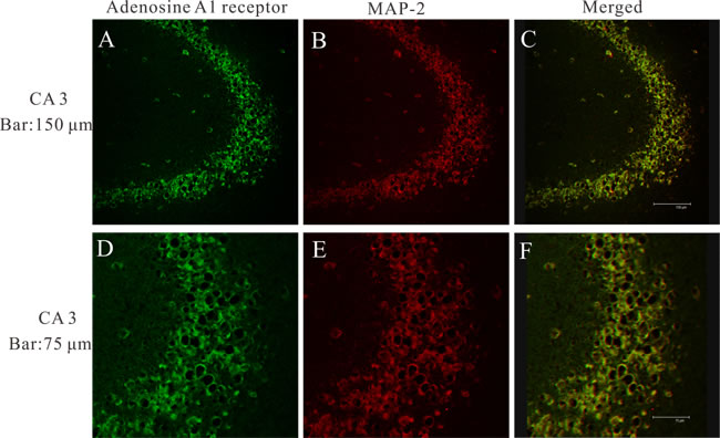 A laser scanning confocal image of adenosine A1 receptor in epileptic rat 24 h after seizures.