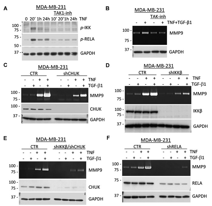TAK1 signaling is essential for the induction of MMP9 by TNF and TGF-&#x3b2; cytokines.