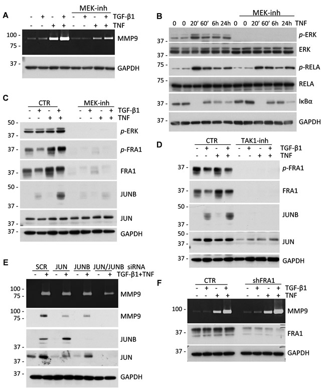 MAPK-AP1 signaling contributes to the up-regulation of MMP9 but FRA1 is dispensable for MMP9 expression.