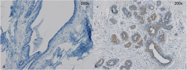 Two representative cases for Wnt4 staining.