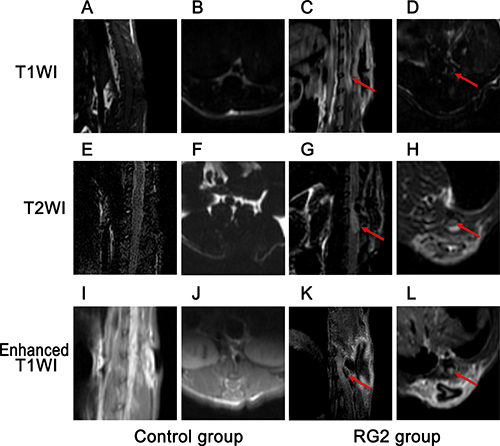 Neuro-imaging reveals phenotype in RG2 tumor rats.