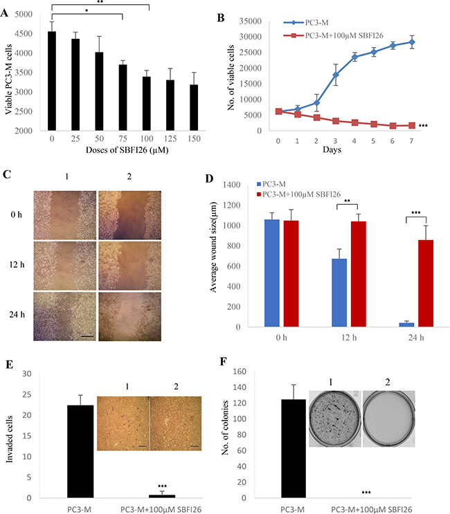 Inhibitory effect of SBFI26 on proliferation, migration, invasion and anchorage-independent growth of the androgen-independent PC3-M prostate cancer cells.