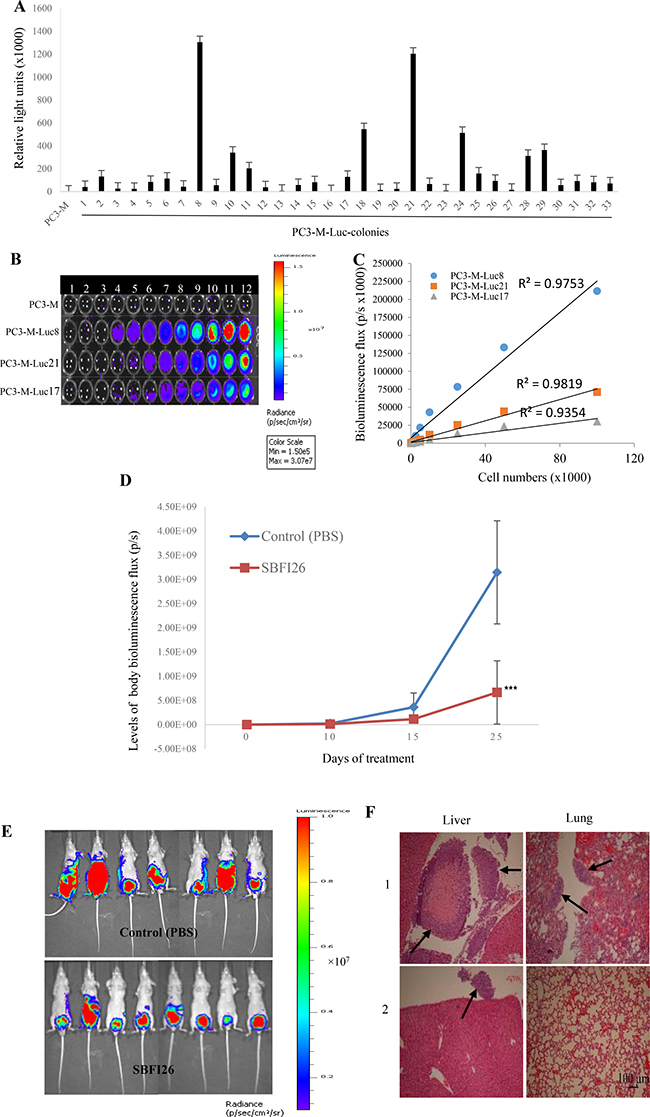 Inhibitory effect of SBFI26 on tumorigenicity and metastatic ability of PC3-M cells implanted orthotopically into the prostate gland of the nude mouse.
