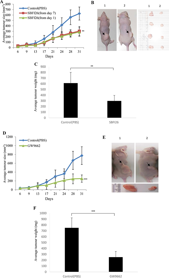 Effect of SBFI26 or GW9662 on tumorigenicity in prostate cancer xenograft mice.
