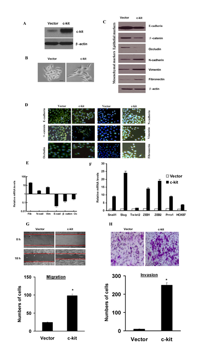 Ectopic expression of c-kit in ACC-M cells induced an EMT program.