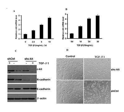 c-kit was necessary for TGF-&#x3b2;&#x2013;induced EMT.