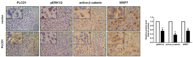 Expression of PLCD1, pERK1/2, active-&#x03B2;-catenin and MMP7 in MDA-MB-231 xenografts in nude mice (magnification &#x00D7;400).
