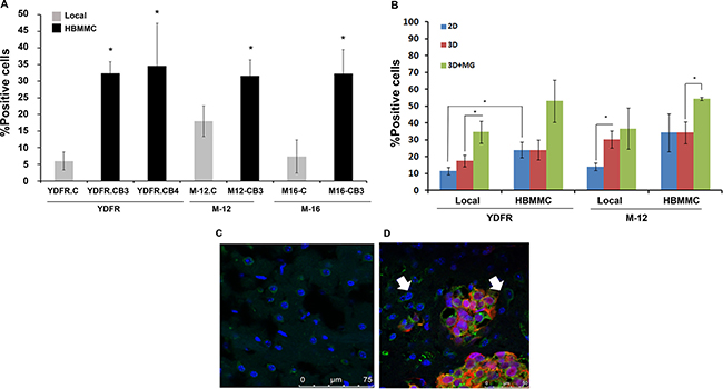 CCR4 is upregulated in brain-tropic melanoma cells.