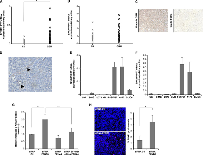 EphrinB3 is highly expressed in glioblastoma tumors and acts as a survival factor for glioblastoma cells, via inhibition of EphA4-induced cell death.