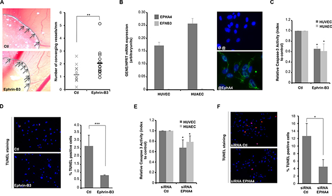 Ephrin-B3 promotes angiogenesis in vitro through inhibition of EphA4-induced cell death.