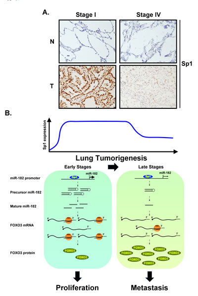 (A) Clinical samples from lung cancer patients of stage I and IV were used to study the Sp1 level by IHC staining with anti-Sp1 antibodies.