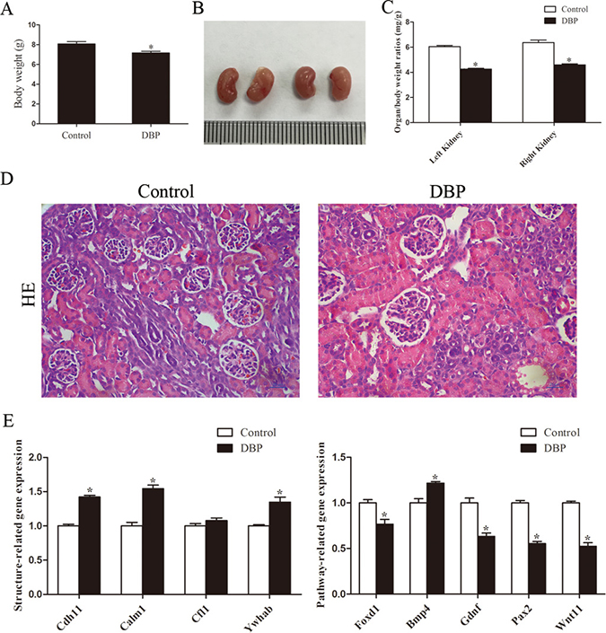 Maternal exposure to DBP induces kidney dysplasia in rat offspring on PND1.