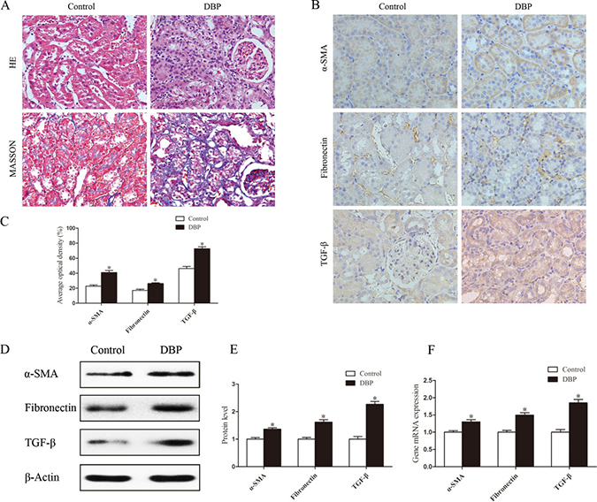 Maternal exposure to DBP leads to renal fibrosis in adult offspring.