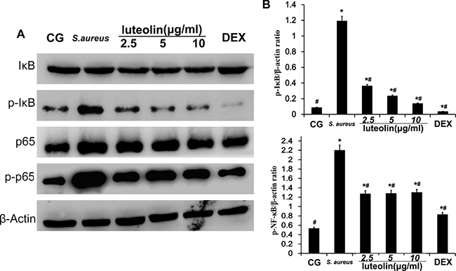 Effects of luteolin on the NF-&#x03BA;B pathway in mammary epithelial cells.
