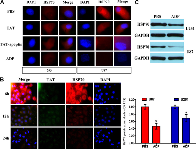 ADP downregulates HSP70 expression in GBM cells.