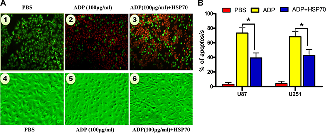 HSP70 antagonizes ADP-induced apoptosis in U87-MG tumor cells.
