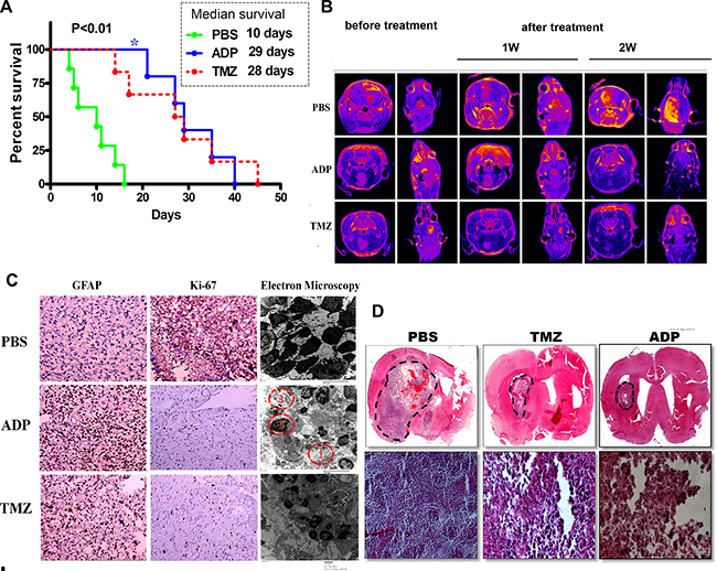 Evaluation of ADP therapeutic effect in an orthotopic glioma model.