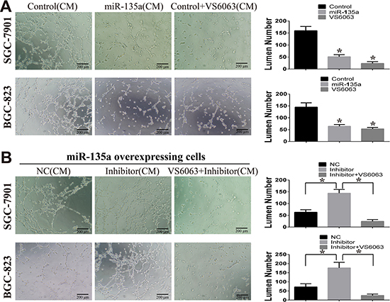 miR-135a suppress tubules formation of HUVEC cells.