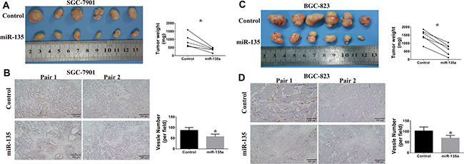 Effects of miR-135a on tumor growth and angiogenesis in vivo.