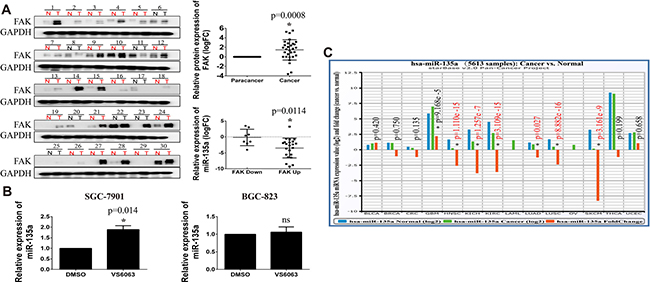 FAK is upregulated in gastric cancer and negatively correlated with miR-135a.