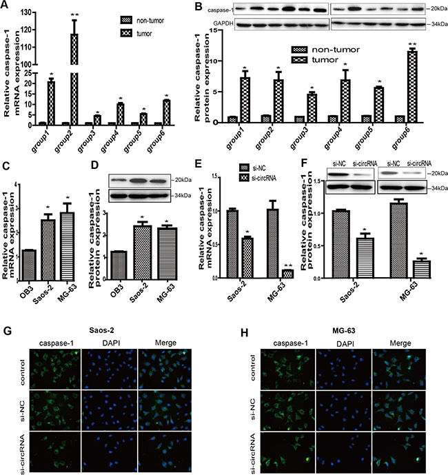 Circ-0016347 was positively related to the expression of caspase-1 in osteosarcoma.