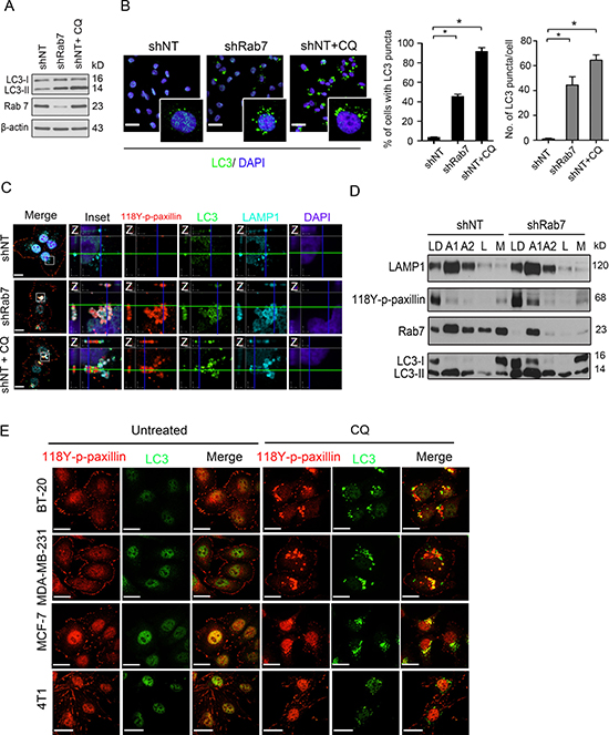 Knockdown Rab7 mimics the effect of chloroquine to localize paxillin into autophagolysosomes.