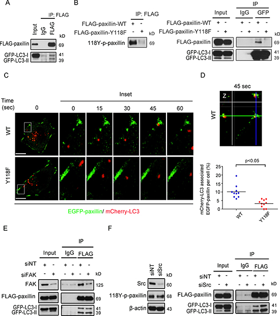 Tyrosine 118 phosphorylation of paxillin modulates its association with the autophagic marker LC3 at cell plasma membrane protrusions.