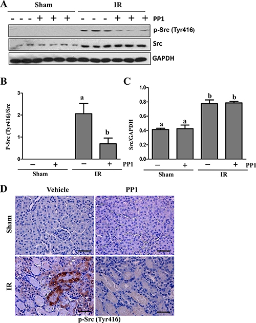 PP1 inhibits Src phosphorylation in the kidney of mice after I/R injury.