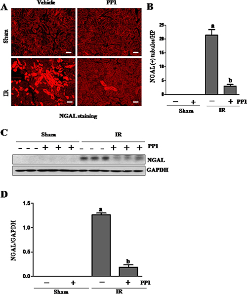 PP1 inhibits the expression of NGAL in the kidney after I/R injury.