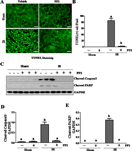 PP1 inhibits apoptosis in the kidney after I/R injury.