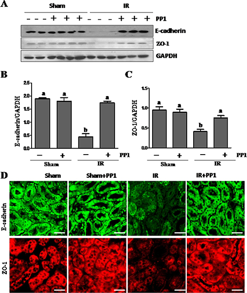 PP1 preserves the expression of E-cadherin and ZO-1 in kidney after renal IRI.