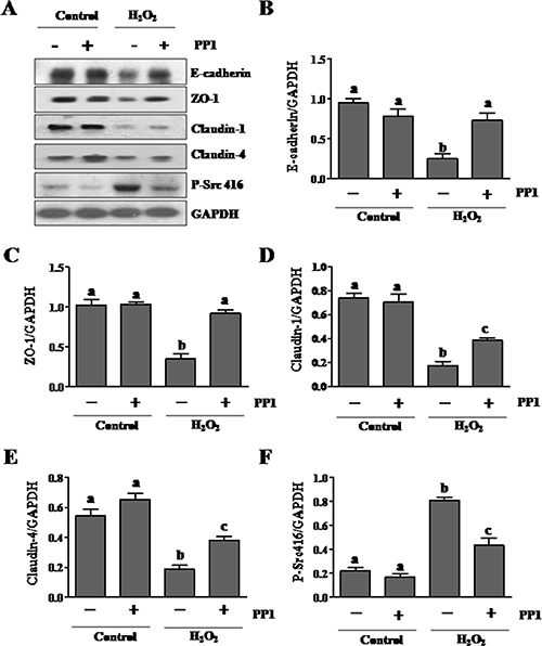 PP1 treatment preserves expression of E-cadherin, ZO-1, claudin-1 and claudin-4 in cultured renal tubule epithelial cells exposed to oxidative stress.