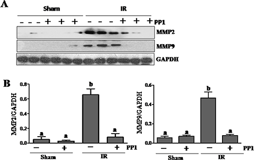 PP1 inhibits expression of MMP2 and MMP9 in the kidney after I/R injury.