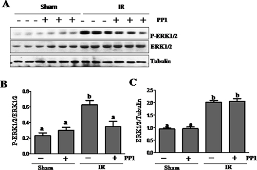 PP1 inhibitsERK1/2 phosphorylation in the kidney after I/R injury.