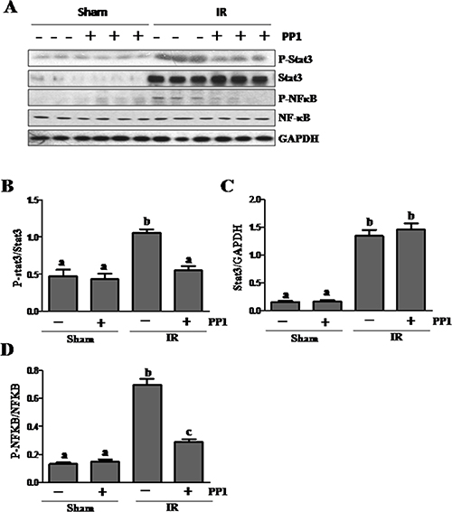 PP1 inhibits STAT3 and NF-&#x03BA;B phosphorylation in the kidney after I/R injury.