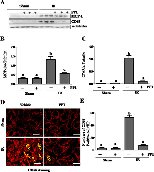 PP1 inhibits MCP-1 expression and macrophage infiltration in the kidney after I/R injury.