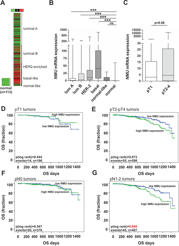 NMU mRNA expression in an independent breast cancer cohort and its clinical impact in advanced tumor stages.