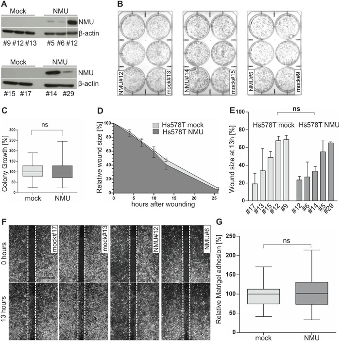 Ectopic NMU expression has no effect on NMUR2-negative Hs578T cells.