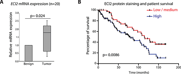 Enoyl-CoA delta isomerase 2 (ECI2) is over-expressed in prostate cancer.