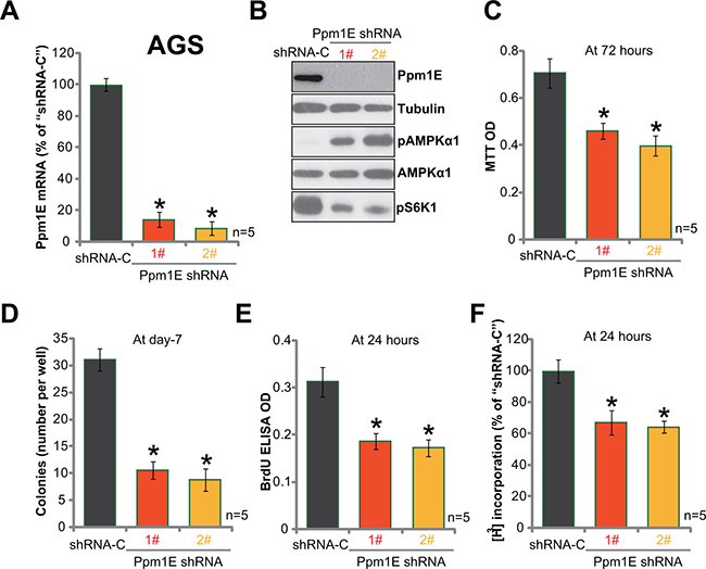 Ppm1E silence induces AMPK activation and inhibits gastric cancer cell survival and proliferation.