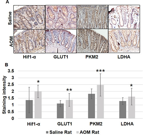 Metabolic changes in uninvolved mucosa by IHC in AOM model.
