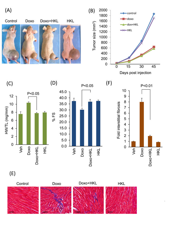 HKL treatment protected mouse hearts without affecting the anti-cancer potency of doxorubicin.