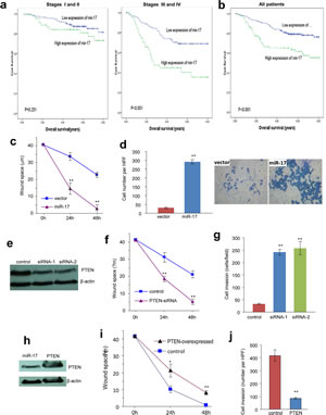 Fig 6: Overexpression of miR-17-5p is associated with tumour metastasis and poor survival.