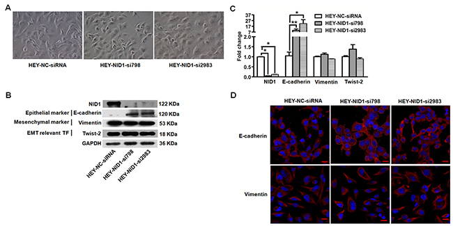 NID1 silencing in HEY cells induced partial MET process.