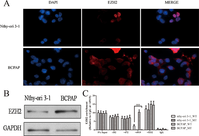 EZH2 expression and location in thryoid cancer cells.
