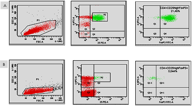 Representative flow cytometric dot plots showing the percentage of Treg cells before commencing therapy (A) and after 30 days of treatment (B).