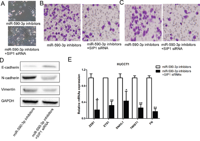 Loss-of-function studies showed that SIP1 siRNA abrogate the of miR-21 inhibitors-induced EMT, cell migration and invasion in ICC in vitro.