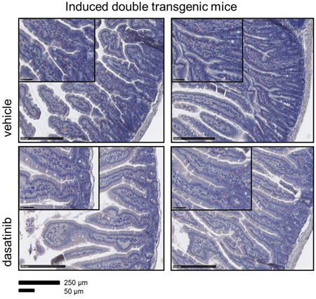 Reduced infiltration of the small intestine by granulocytes in dasatinib treated dtg mice.
